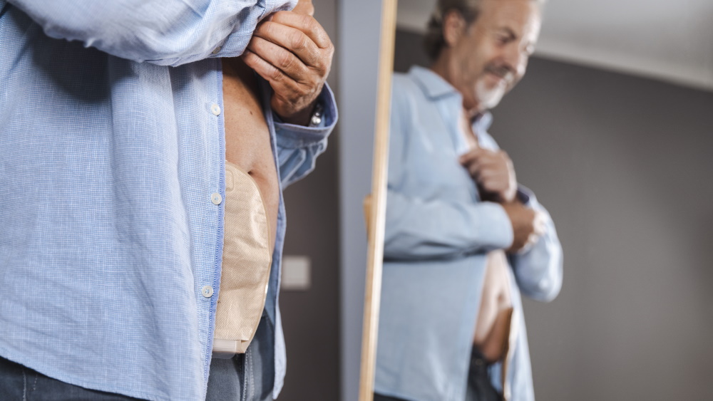 Colostomie Trouvez La Poche De Colostomie Adapt e Votre Type colostomie-trouvez-la-poche-de-colostomie-adapt-e-votre-type